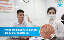 Hướng dẫn cách trị mụn trứng cá tuổi dậy thì